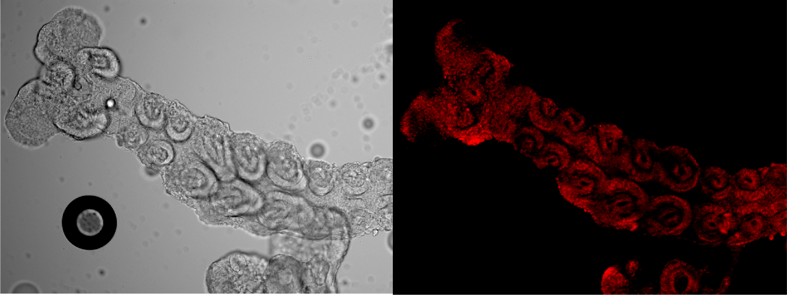 Imatge inicial - Blattella germanica embryo genetically modified with DIPA-CRISPR: the four-day-old embryo has successfully inserted the mCherry gene, which produces a red fluorescent protein, revealing the location of the protein expressed by distal-less, a key gene in embryonic development. Credit: Alfonso Ferrández-Roldán.