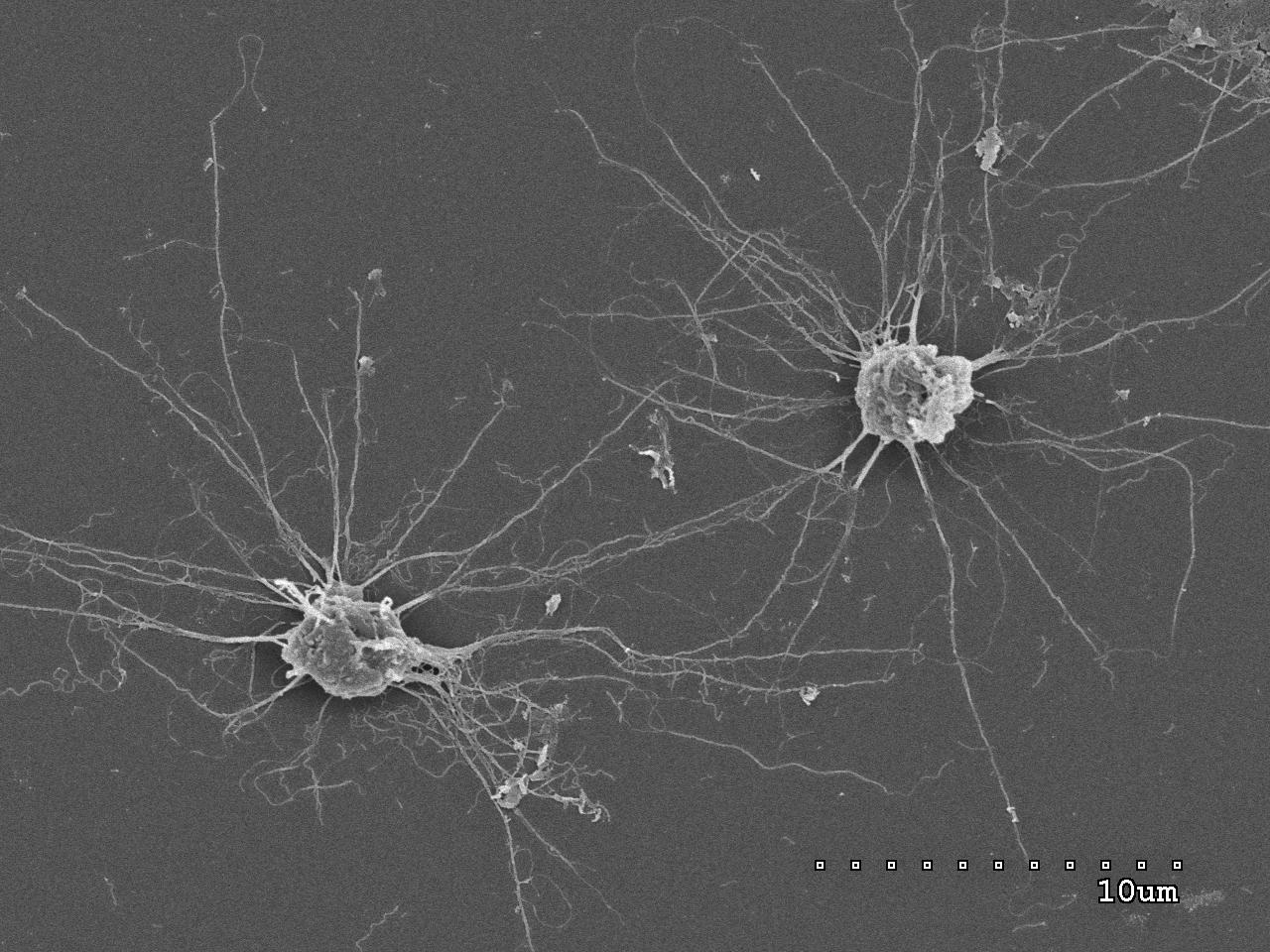 Imatge inicial - Capsaspora owczarzaki, SEM microscopy. Credit: Multicellgenome Lab