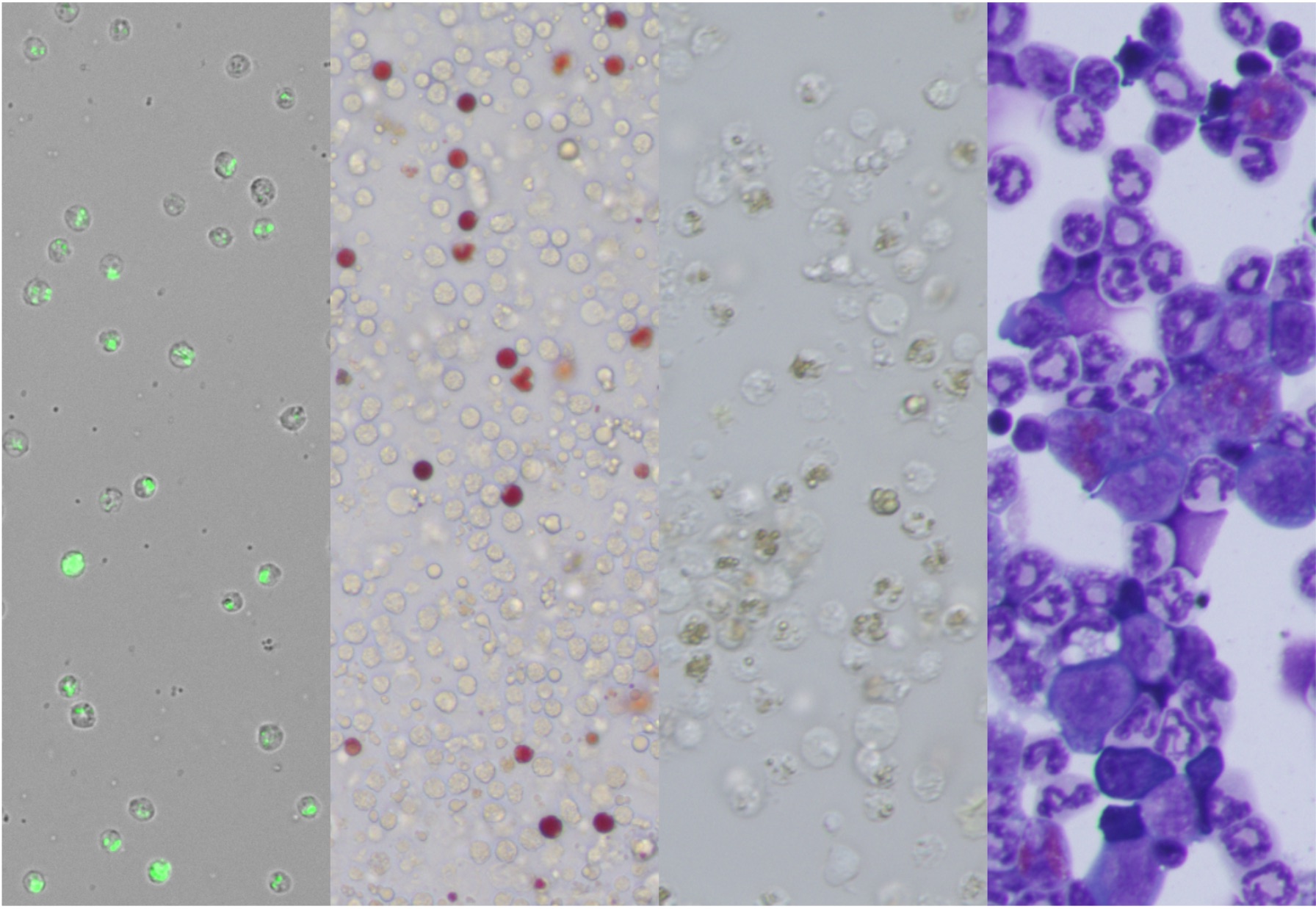 Imatge inicial - Far left, Capsaspora owczarzaki engulfing fluorescent bacterium beads; middle left, sea urchin whole blood cells; middle right, tunicate test cells in ovary; far right, mouse whole bone marrow cells with Wright-Giemsa Staining. Credit: Yosuke Nagahata