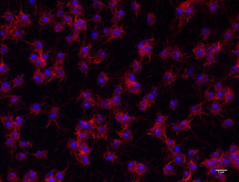 Imatge inicial - Adherent cells of Capsaspora owczarzaki (Filasterea). Fluorescence microscopy (63x). Nuclei stained with DAPI (blue) and actin stained with phalloidin (red). Credit: Multicellgenome Lab, via Flickr. CC BY 2.0.