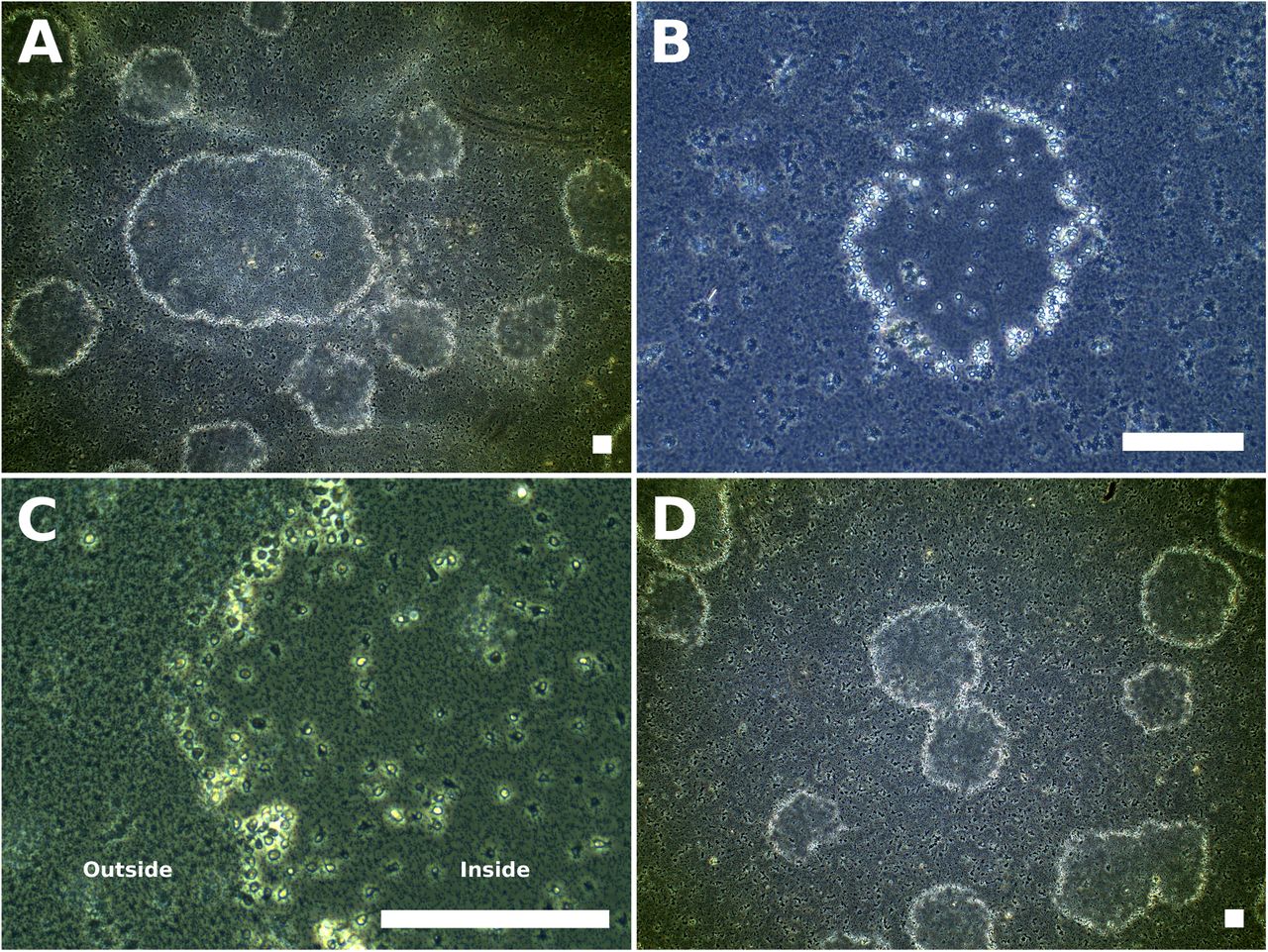 A new lineage of amoebae forms multicellular ring-shaped structures. Phase-contrast microscopy; scale bar: 125 μm. Image adapted from Gàlvez-Morante, Berney and Richter, bioRxiv, 2025. CC BY 4.0 licence. Imatge inicial - A new lineage of amoebae forms multicellular ring-shaped structures. Phase-contrast microscopy; scale bar: 125 μm. Image adapted from Gàlvez-Morante, Berney and Richter, bioRxiv, 2025. CC BY 4.0 licence.