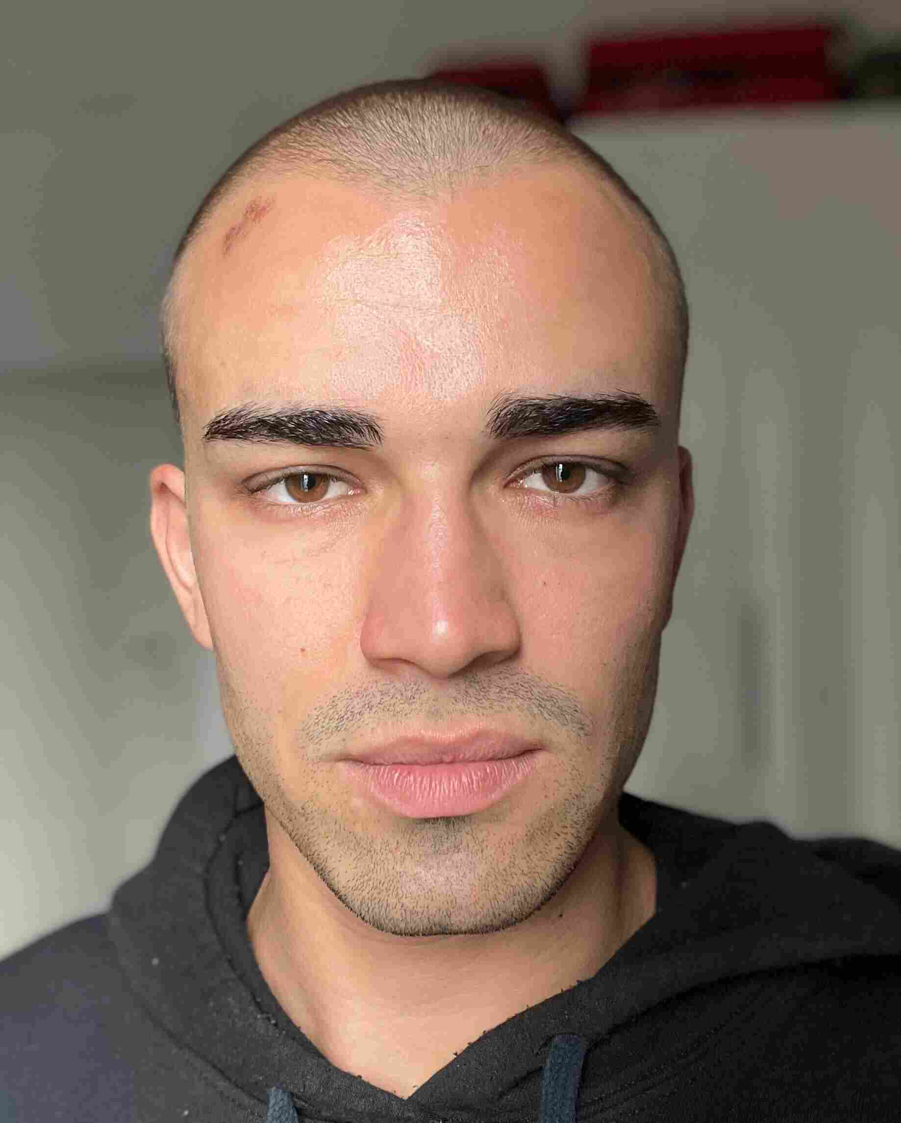 Andrea Lenti 