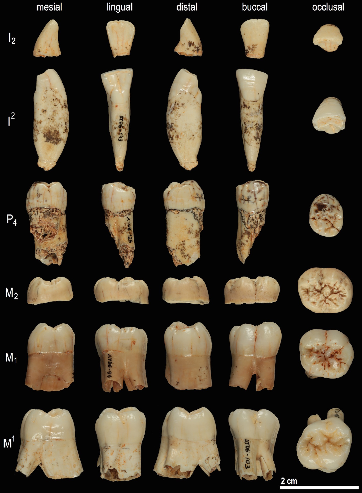 Se estudió un diente de Homo antecessor utilizando análisis de proteínas antiguas. Crédito: Prof. José María Bermúdez de Castro.