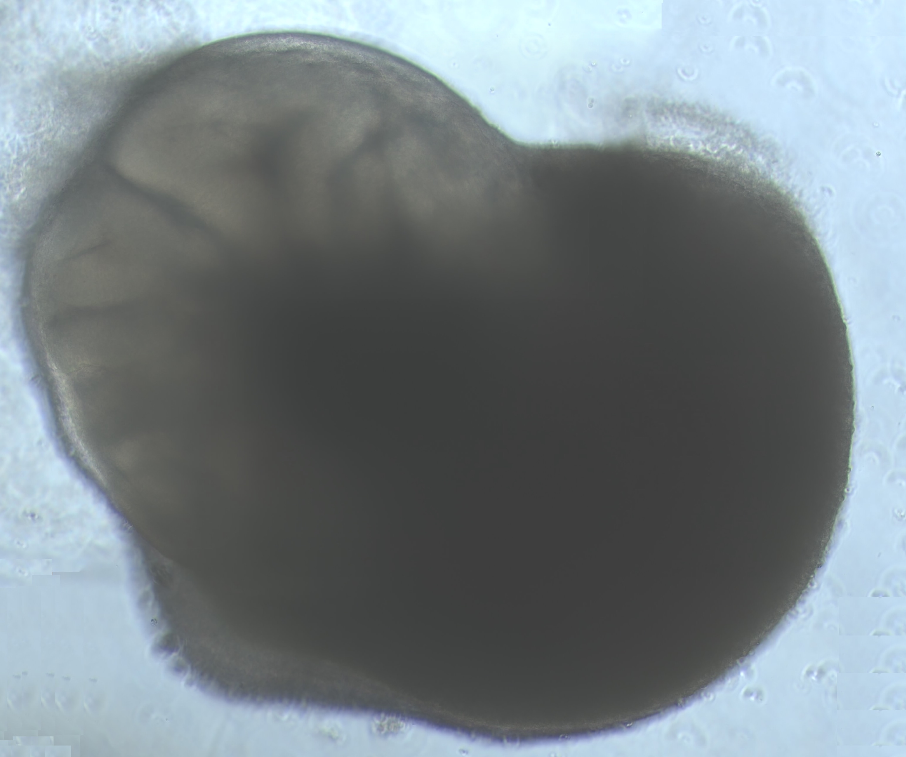 Organoide de cerebro. Fuente: Sandra Acosta.