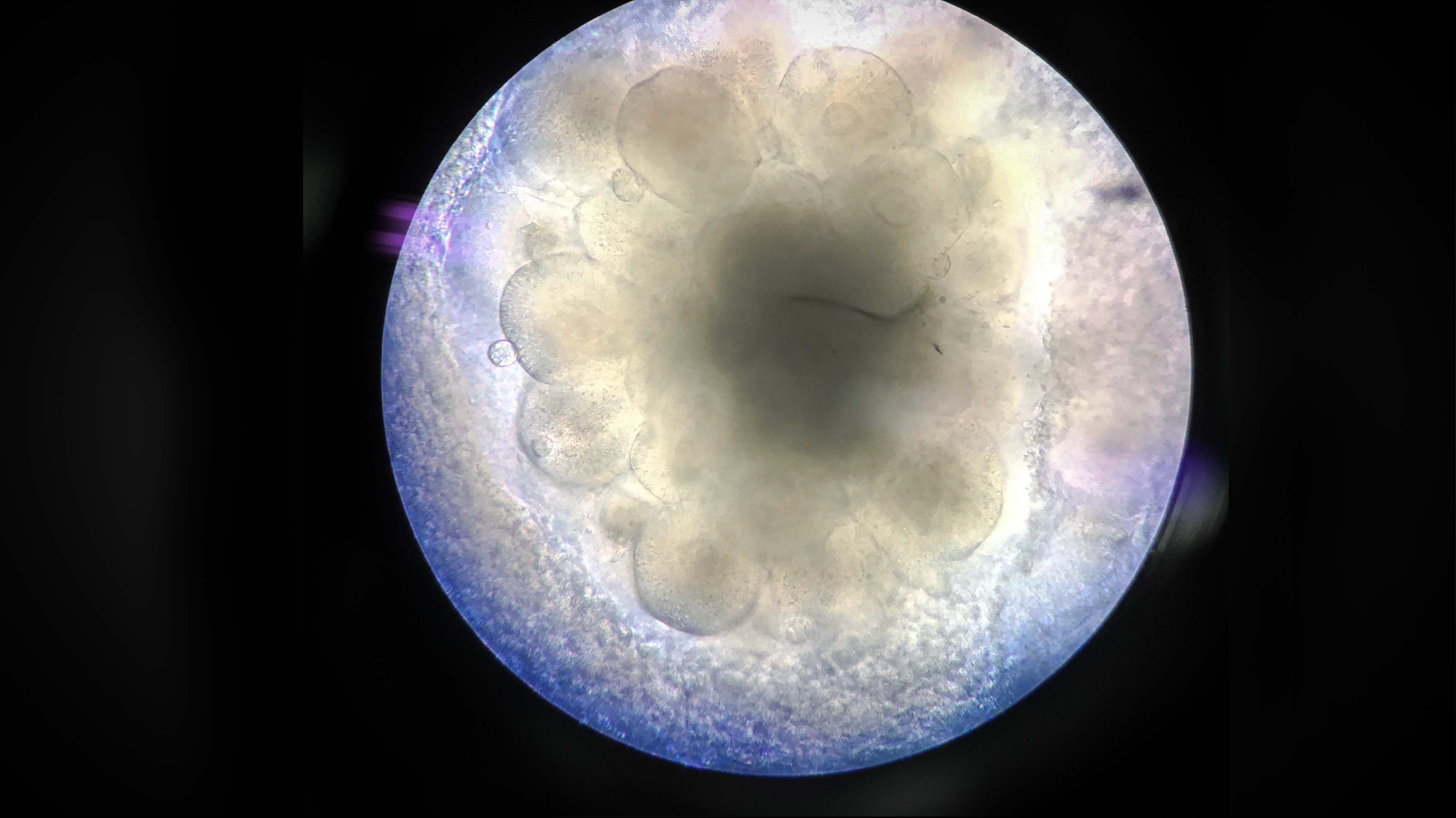 Organoide de cerebro de células madre embrionarias humanas. Crédito: Sandra Acosta.