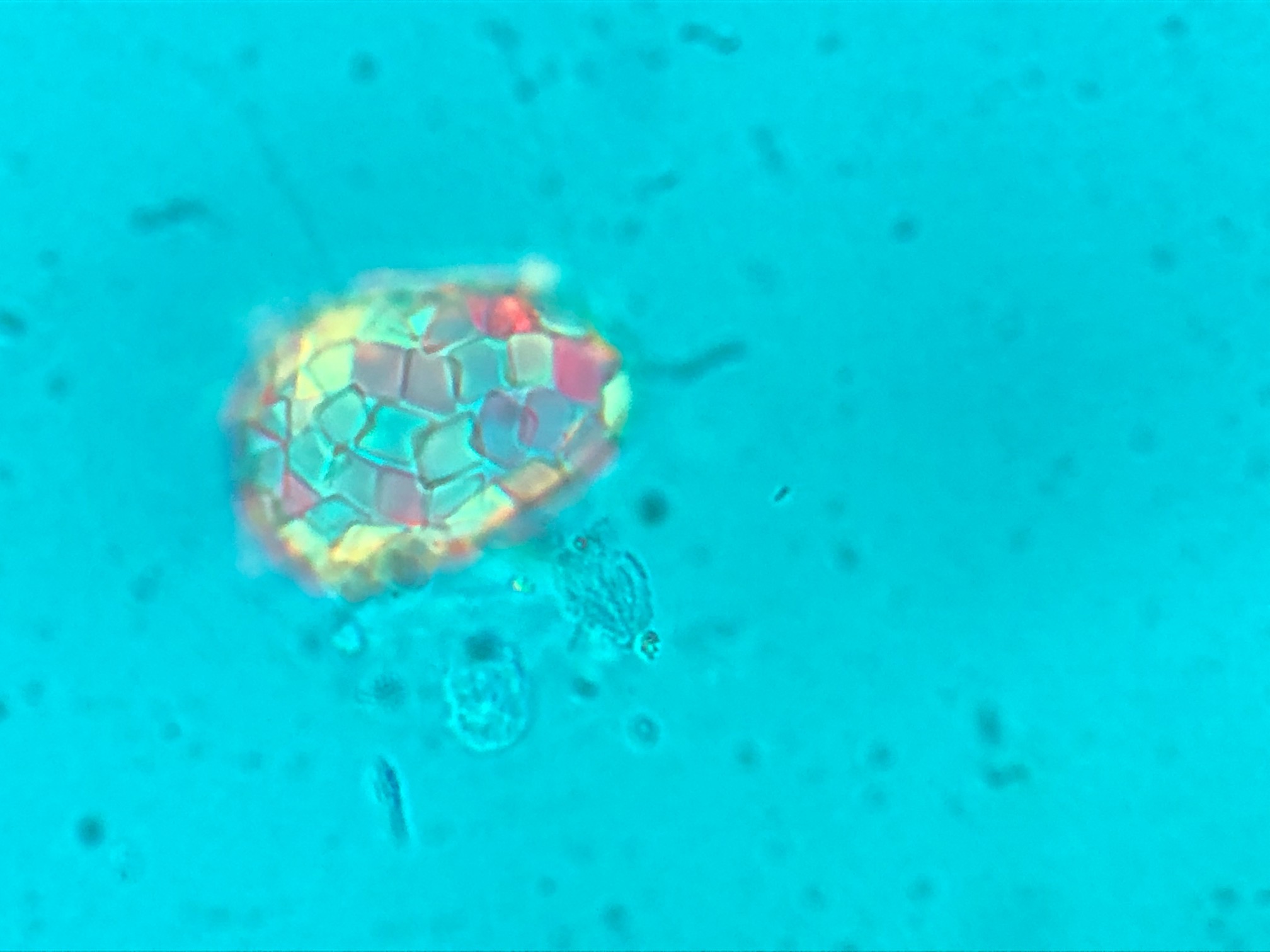 En el análisis inicial descubrieron una nueva especie de ameba (que de momento han llamado Astroquadrula).